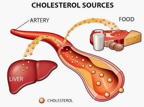 High cholesterol and liver disease